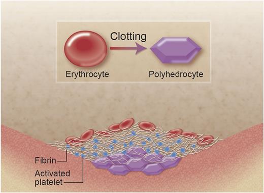 A new shape of the red blood cell helps to seal the clot. The erythrocyte (red blood cell, on the left) loses its typical biconcave shape when it is incorporated into the clot. In particular, at the center of the blood clot, due to the pressures induced by clot contraction (platelets pulling at fibrin fibers), the red blood cell takes up a different, new shape of a polyhedrocyte (right). The polyhedrocyte is characterized by flat surfaces and straight edges, which, when packed closely together, makes an almost perfect seal at the center of the blood clot, reducing blood loss.1 Professional illustration by Alice Y. Chen.