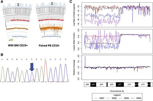Figure 3. aUPD in chromosome 3p in 4 patients with WM. (A) Representative excerpts from paired tumor and germline tissue documenting an aUPD on chromosome 3 for a single WM patient. The red histogram below the ideogram corresponds to the heterozygous call rate. Below that, copy number (black line) and normalized relative coverage (orange) is shown above the LAF measurements (blue). LAF values more than 2 standard deviations from the mean are shown in green. (B) Sanger sequencing of MYD88 L265P for this patient with a near homozygous mutant signal. (C) Heterozygous call rate, LAF, and relative coverage for the 4 patients with aUPDs in chromosome 3p demonstrating the near identical location of the aUPD for the 4 affected patients.