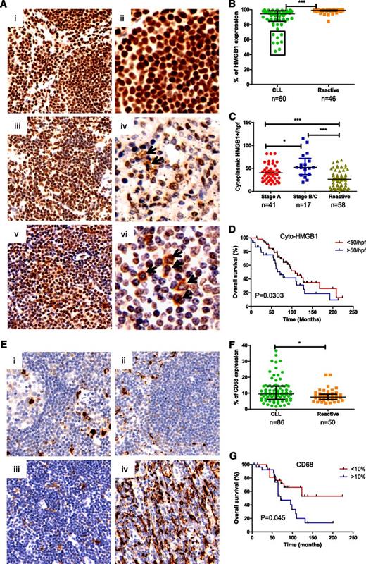 Figure 2. Determination of HMGB1 and CD68 expression in tissue microarrays. (A) Representative samples of HMGB1 expression in (i-ii) reactive and (iii-vi) CLL lymph nodes. Images were taken with a Leixa DM2500 microscope: i, iii, and v, original magnification ×200); ii, iv, and vi, original magnification ×400. (B) Overall HMGB1 expression. HMGB1 expression was determined by a computerized image analysis Ariol system using pathologist-trained visual parameters. All cores were reviewed manually before scoring, and only intact cores were used for scoring. Each datum represents an average of triplicate cores. There was a statistically significant decrease in expression of percentage of cells expressing HMGB1 in CLL compared with reactive LNs. (C) Cytoplasmic HMGB1 expression. Numbers of cytoplasmic HMGB1-positive cells were counted blindly by 2 reviewers in 4 high power fields (hpfs) and expressed as a mean value from triplicate cores. (D) Overall survival of CLL patients based on low (<50) and high (>50) numbers of cells containing cytoplasmic HMGB1 in 4 counted hpfs, with the cutoff determined using X-tiles software. (E) Expression of CD68 in (i-ii) reactive and CLL-LN with (iiii) lower and (iv) higher CD68 expression. (F) Statistical comparison of CD68 expression in CLL-LN and RA-LN. (G) Overall survival of CLL patients based on low (<10%) and high (>10%) expression of CD68.