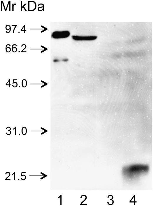 Figure 4. The binding of anti-FXIII-B(2) antibody to recombinant FXIII-B and its combined 1+2 sushi domains (SD1+2). FXIII-B and SD1+2 were expressed in insect cells as described in the text. Cell culture supernatants were concentrated and analyzed by western blotting. Lane 1: FXIII-B isolated from the plasma (the faint band below FXIII-B corresponds to a proteolytic product); lane 2: supernatant of cultured cells expressing rFXIII-B; lane 3: supernatant of mock-transfected cells; lane 4: supernatant of cells expressing SD1+2.