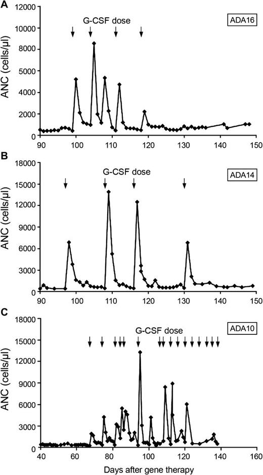 Figure 3. Response to G-CSF after low-dose busulfan conditioning. Arrows represent G-CSF doses. (A) Patient ADA16. (B) Patient ADA14. (C) Patient ADA10.