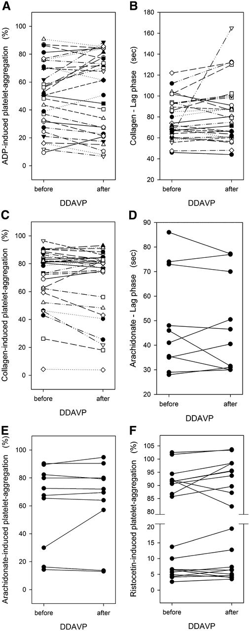 Figure 2. Effect of in vivo DDAVP on platelet aggregation in PRP. Whole blood was drawn before and 4 hours after start of the DDAVP infusion in 10 patients with congenital platelet function defects. (A) ADP-induced platelet aggregation at 3 minutes, (B) lag phase of collagen-induced platelet aggregation, (C) collagen-induced platelet aggregation at 3 minutes, (D) lag phase of arachidonate-induced platelet aggregation, (E) arachidonate-induced platelet aggregation at 3 minutes, and (F) ristocetin-induced platelet agglutination at 3 minutes. See “Material and methods” for details on agonist concentrations. Changes were not statistically significant (see Table 1 for P values). In panels A-C, the symbols depict paired values for individual patients, before and after DDAVP.