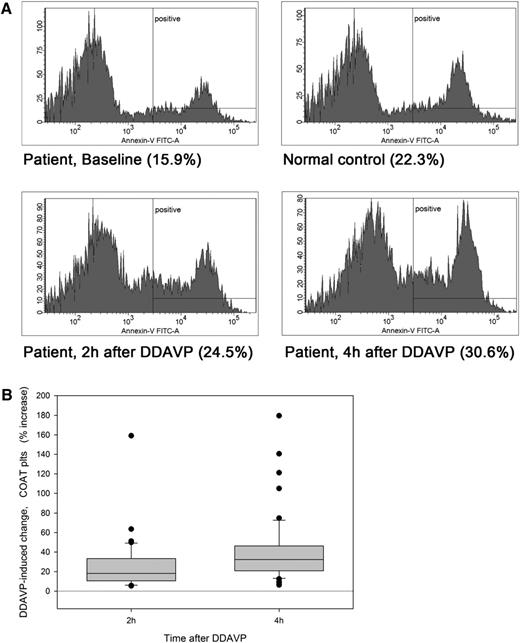 Figure 4. Effect of DDAVP on COAT platelet formation. (A) COAT platelets at baseline (15.9%), 2 hours (24.5%), and 4 hours (30.6%) after DDAVP in a typical patient. For comparison, COAT platelets of the normal control (22.3%) are shown. (B) Relative COAT platelet increase in responding patients (n = 37 of 52 at 2 hours; n = 45 of 52 at 4 hours; P < .001 for both comparisons). Box plots in 4B visualize the median value (horizontal line within the box), the 25th and 75th percentiles (lower and upper borders of the box), the 10th and 90th percentiles (lower and upper whiskers), and each outlier outside the 10th and 90th percentiles (black circles).