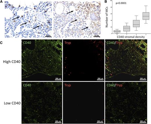 Figure 3. MCs are spatially associated with areas of dense CD40 stromal expression. In BM biopsies with high CD40 stromal expression, tryptase+ MCs were observed within neoplastic lymphoid aggregates and showed a higher density in areas with stronger CD40 expression. Such association is detectable by immunohistochemical analysis for MC tryptase and CD40 (brown signals) on BMB serial sections (A) and by double-marker immunofluorescence on confocal microscopy for the same markers (CD40, green signal; tryptase, red signal) (C). Immunohistochemistry, STREPTavidin–biotin–peroxidase complex method, DAB chromogen; original magnification ×400. Immunofluorescence with Alexa-488 and Alexa-568 fluorochromes; original magnification ×200. Microphotographs are relative to 2 representative cases with high (score 3) and low (score 1) CD40 stromal expression. (B) Significant positive correlation between the degree of infiltrating tryptase+ and CD40+ BMSCs in SMZL patients.