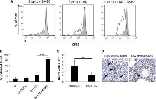 Figure 6. Interaction between BMSCs and MCs results in an increased mature B-cell proliferation. (A-B) CD19+CD21+IgM+ circulating B cells obtained from healthy donors increase their proliferative rate when cocultured with BMSC-MC in the absence of additional stimuli. (C-D) The number of Ki-67+ cells in the CD40 low and CD40 high groups indicates a higher proliferation rate in cases with high CD40 expression in the BM stroma. Immunohistochemistry, STREPTavidin–biotin–peroxidase complex method, DAB chromogen; original magnification ×400. Microphotographs are relative to 2 representative cases with high (score 3) and low (score 1) CD40 stromal expression. **P < .01; ***P < .001.