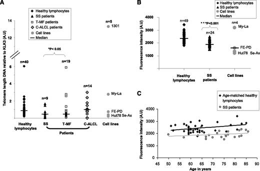 Figure 1. Evaluation of relative TL in CTCL patients. (A) qPCR showed that TL was significantly shorter in SS and T-MF patient tumor cells than in healthy lymphocytes. C-ALCL patient tumor cells exhibited a TL similar to that in healthy lymphocytes. (B) IQFISH measurement confirmed that TL was shorter in SS blood samples than in healthy lymphocytes. (C) Graph shows that TL in SS blood samples was not influenced by older age in patients. TL was shorter in SS group than in age-matched controls. A.U, arbitrary units.