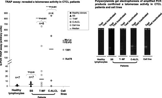 Figure 4. TA evaluated in CTCL patient cells and cell lines. In contrast with healthy lymphocytes, TA was detected in CTCL patient tumor cells (SS, T-MF, and C-ALCL) and in cell lines by using TRAPeze RT telomerase detection kit and was also confirmed by running amplified PCR products on polyacrylamide gel.