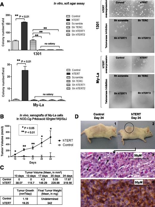 Figure 6. Effects of telomerase variation on cell tumorigenicity. (A) Soft agar assays were performed for 1301, My-La, FE-PD, and Hut78 cells after viral infection for hTERT overexpression or telomerase inhibition. No colony formation could be observed for FE-PD and Hut78 cells. For 1301 and My-La cells, colonies (>8 cells) were counted in 3 different fields per well. Results were expressed as mean from experiments done in triplicate; vertical bars indicate standard deviation. Significant difference was based on Student t test (**P < .01) vs control (DsRed for hTERT overexpression, and Scramble for telomerase inhibition). (B) Graph shows tumor growth in NOD.Cg-Prkdcscid Il2rgtm1Wjl/SzJ mice implanted with My-La cells overexpressing hTERT or not (control). In all, 1 × 106 cells were xenografted in 8 mice for each condition, and tumor size was measured twice a week for 24 days. Significant difference was based on Student t test (**P < .01) vs control. (C) Tumor growth (mm3 per day) and final tumor weight were determined at day 24. (D) In all hTERT conditions, visible tumors were detected (2) compared with control mice (1). MyLa cell–derived tumors were stained with Mayer’s hematoxylin (3), and immunohistochemistry identified T-cell staining for CD3 (4) (Dako Cytomation).