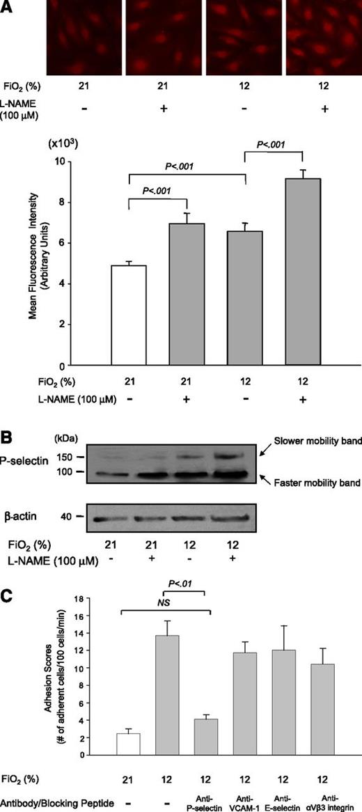 Figure 5. Expression of P-selectin on HUVECs is regulated by hypoxia and NO bioavailability and its role in sRBC adhesion. (A) Effects of hypoxia and the eNOS inhibitor l-NAME on P-selectin expression on HUVECs. P-selectin expression on the cell surface of HUVECs was evaluated by immunofluorescence microscopy. Cells were treated with room air (Fio2 = 21%) or hypoxia of 12% O2 for 1 hour with or without l-NAME (100 μM). Images were taken at ×400 (upper panel). MFIs were calculated by scanning fluorescence images with ImageJ v1.43 (NIH). Results with MFI for each experiment are shown in the lower panel. Values were mean ± SEM from 3 to 4 images taken for each treatment with at least 5 cells analyzed per image. (B) Analysis of P-selectin expression in HUVECs by western blotting. Cells were treated as described previously, and the cell membrane fractions were isolated and subjected to western blot analysis. Note that the intensity of a slower-mobility protein band at 140 kDa is increased in response to hypoxia and l-NAME treatment. (C) Effect of blocking antibodies on sRBC adhesion in eNOS-deficient mice under hypoxia. eNOS-deficient mice were infused with antibody against P-selectin, VCAM-1, and E-selectin or αvβ3-integrin blocking peptide before intravital experiments, and the adhesion scores of sRBCs were measured. Values were mean ± SEM from 5 to 7 mice in each group. P values are shown at the top of the figure.