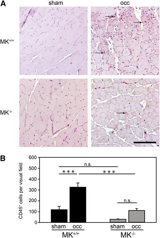 Figure 2. Leukocyte extravasation was compromised in MK−/− mice during hypoxia-mediated inflammation. (A) Representative histological sections of Mm. gastrocnemii from MK+/+ or MK−/− mice 4 days after ligation of the femoral artery in the right leg (occ) and sham operation of the left leg (sham). Immunohistochemical staining of CD45+ cells (red) indicated by arrows. Bar = 100 μm. (B) Quantitative analysis of leukocyte extravasation measured as CD45+ cells per visual field; n = 3 independent experiments. Diagram shows mean ± SEM. ***P < .001.