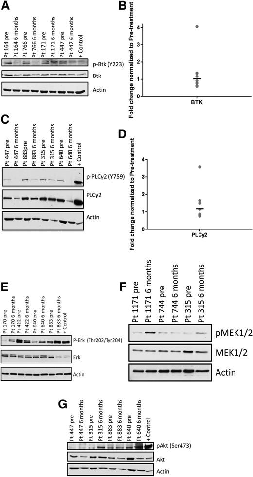 Figure 1. Protein and gene expression of BCR signaling components in persistent lymphocytes compared with baseline. Phosphorylated and total protein expression of various signaling molecules of the BCR pathway and gene expression of BTK and PLCγ2 were investigated in patients with persistent lymphocytosis. Serial samples were taken at baseline and at 6 or 9 months after initiation of therapy. Each immunoblot shown is representative of multiple patients evaluated, and statistics presented in the text show the mean change of all evaluated patients. Number of patients evaluated was determined by amount of sample available. (A) pBTK (Y223), as well as (C) pPLCγ2 (Y759) decrease in the majority of patients after ibrutinib therapy. (E) pERK (Thr202/Tyr204), (F) pMEK1/2 (Ser217/221), and (G) pAKT (Ser473) increase in the majority of patients with prolonged lymphocytosis during ibrutinib therapy. Gene expression of (B) BTK and (D) PLCγ2 does not change over time in the majority of patients.