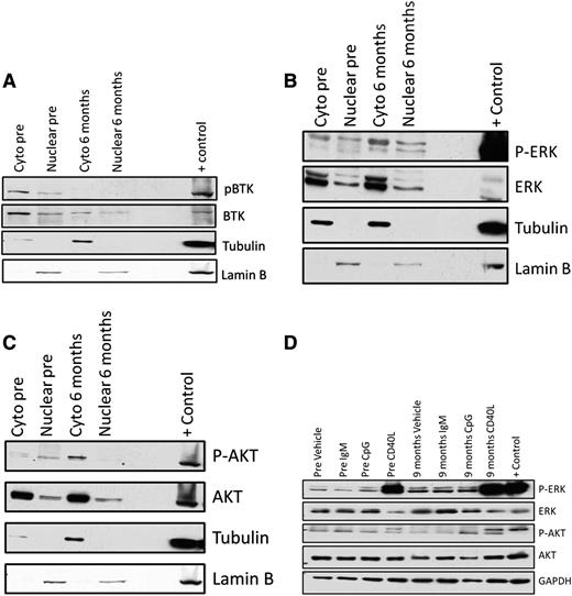 Figure 2. Nuclear and cytoplasmic localization of BTK, ERK, and AKT in persistent lymphocytes following ibrutinib therapy and ability of persistent lymphocytes to stimulate. Nuclear and cytoplasmic localization of BCR signaling pathway proteins was evaluated using nuclear and cytoplasmic lysates from patients at baseline and after 6 months of ibrutinib therapy. In these representative immunoblots, there is no evidence of a shift toward nuclear localization of either phosphorylated or total (A) BTK, (B) ERK, or (C) AKT. (D) Patient samples at baseline and after 9 months of therapy were used to evaluate whether persistent lymphocytes can be stimulated through the BCR (15-minute exposure to plate-immobilized IgM; BD Pharmigen), TLR9 (3.2 μM CpG; Eurofins MWG Operon), or distal to BTK (1 μg/mL CD40L; PeproTech). (D) In this representative immunoblot, mild stimulation with CpG is seen at baseline along with robust stimulation following CD40L. After 9 months of ibrutinib therapy, CD40L alone is able to stimulate CLL cells.