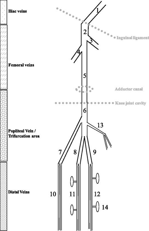 Figure 1. Schematic representation of leg veins as discussed in this review. 1, External iliac vein; 2, common femoral vein; 3, greater saphenous vein; 4, profound femoral vein; 5, (superficial) femoral vein; 6, popliteal vein; 7, anterior tibial confluent segment; 8, posterior tibial confluent segment; 9, peroneal confluent segment; 10, anterior tibial veins; 11, posterior tibial veins; 12, peroneal veins; 13, gastrocnemius muscle veins (medial head); 14, soleus muscle veins. (From Palareti G, Schellong S. Isolated distal DVT: what we know and what we are doing. J Thromb Haemost. 2012;10:11-19)