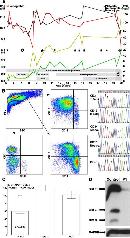 Figure 1. Biological, phenotypical, molecular and functional analyses. (A) Hematobiological evolution of the patient with treatment courses. A-CD20, rituximab; SplX, splenectomy; VP16, etoposide; *, pneumopathy, #, pericarditis associated to arthritis; ☆, colic B-cell proliferation; ★, Evans syndrome aggravation with spleen enlargement crisis and circulating B-cell proliferation; ✜, acute myeloproliferation with pulmonary infiltration leading to death. (B) Cell sorting and sequencing of circulating leukocytes populations and primary derived fibroblasts. Fibro., fibroblasts; Mono., monocytes; Neutro, neutrophils. (C) In vitro apoptosis assays on superantigen stimulated T cells from the patient; results are compared with controls. ACAD, activated cells autonomous death using cytokines withdrawal; AICD, activation-induced cell death by T-cell receptor restimulation; Apo1.3, direct Fas stimulation with an agonist antibody. (D) Western blot of patient’s (P1) Bim expression on activated T cells. GAPDH, glyceraldehyde-3-phosphate dehydrogenase.