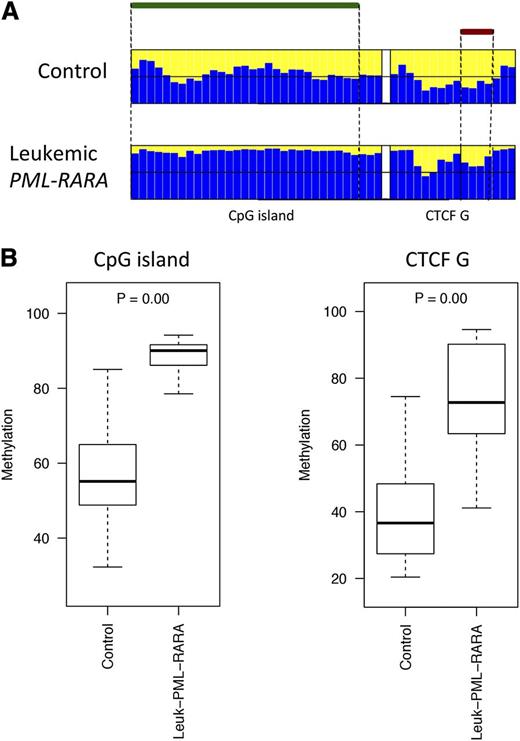 Figure 5. Comparison of the DNA methylation profiles in murine leukemic and nonleukemic control cells. (A) Bar plots of the average methylation level for each CpG site (blue columns). The leukemic murine cells exhibited a distinctive hypermethylation at both regions compared with the nonleukemic counterpart. A black horizontal line indicates the 50% level of methylation. Amplicon names are indicated underneath the bar plots. Samples types are labeled on the left of each panel. The CpG island and the CTCF binding site positions are indicated with green and red bars, respectively. (B) Box plots of the methylation-level distribution in the murine samples showing hypermethylation at the CpG island and CTCF G in the leukemic cells. The P values indicate Kruskal-Wallis test results between the APL leukemic cells and the controls.