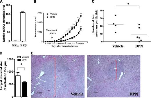 Figure 5. Selective ERβ agonist inhibits growth and dissemination of Raji BL cells in vivo. (A) Expression of ERα and ERβ mRNA in Raji BL was measured by quantitative real-time PCR. (B) Male NOD-SCID mice were subcutaneously grafted with 5 × 106 Raji BL cells. Starting from day 12 after tumor cell grafting, animals were treated subcutaneously daily with the ERβ-selective agonist DPN (12.5 μmol/kg per day) (▪) or vehicle (●). The number (C) and size (D-E) of tumor foci of Raji cell dissemination in liver were significantly reduced in DPN-treated mice with Raji lymphomas as evaluated using hematoxylin and eosin staining. Original magnification ×200. The groups consisted of 4 (vehicle-treated) and 6 (DPN-treated) mice. For vehicle vs DPN: *P < .05, **P < .01, and ***P < .001. Data are representative of at least 2 independent experiments.