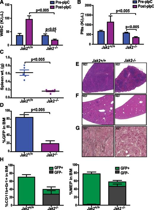 Figure 2. JAK2 plays a critical role in the survival of MPN clone. Excision of Jak2 following disease establishment led to reduction in (A) WBC, (B) platelets, (C) spleen sizes, and (D) GFP-positive cells in BM (P < .005). Loss of JAK2 results in significant improvement in disease features including (E) restoration of splenic architecture, (F) decrease in myeloid infiltration in liver, and (G) reduction in BM fibrosis. (H) There was also a reduction in CD11b+Gr1+ cells and MEP population in MPLW515L-transduced mice lacking Jak2. (Data are represented at mean ± SEM; Jak2+/+, n = 5; Jak2−/−, n = 6).