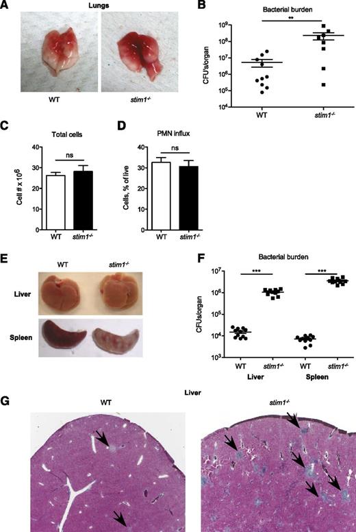 Figure 6. Stim1−/− chimeras have major impairment in host defense to S aureus pneumonia and L monocytogenes septicemia. WT or stim1−/− chimeras were inoculated with S aureus (Newman strain) via direct tracheal intubation. At 24 hours, the mice were euthanized and the lungs were isolated. Representative gross specimens are shown in (A). (B) The left lobe of the lung was homogenized, and serial dilutions were plated for assessment of bacterial colony-forming assays (shown as CFU/organ). Data shown are pooled from 2 independent experiments. n = 10 mice per group. **P < .03. The right lobes were digested with collagenase and cells were collected for total cell count (C) and analysis via flow cytometry (D). Neutrophils were identified by double-staining for CD11b and Ly6G. (E) WT or stim1−/− chimeras were infected by intravenous injection of L monocytogenes into the retroorbital sinus. Liver or spleens were isolated 2 days postinfection. Representative organs are shown. (F) Total tissue homogenates were prepared in LB medium, and samples were plated on LB plates for Listeria colony-forming assays (shown as CFU/mL). Results are pooled from 2 separate experiments. n = 11 mice per group. ***P < .001. (G) Liver samples from WT or stim1−/− chimeric mice obtained 2 days following Listeria infection were stained with trichrome to visualize leukocyte abscesses (shown by arrows). Microscopy sections are at ×10 magnification and are representative of 3 different animals in 2 separate experiments.