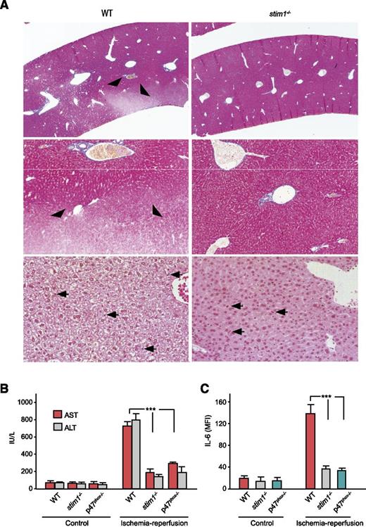 Figure 7. Stim1−/− chimeras have less liver damage following ischemia/reperfusion injury. (A) WT or stim1−/− chimeric mice were subjected to liver ischemia/reperfusion injury by ligation of the portal vein and hepatic artery for 30 minutes followed by 3 hours of reperfusion. Mice were then euthanized, and liver samples were obtained for histology. Liver sections were stained with trichrome (upper 4 panels) or H&E (lower 2 panels). Areas of poor trichome staining (arrowheads) indicate hepatic necrosis in the WT mice, which were absent in livers from stim1−/− chimeras. Arrowheads indicate inflammatory cell infiltrate. Magnification is ×10 (upper panels), ×20 (middle panels) and ×40 (lower panels). Images shown are representative of 10 mice per group subjected to ischemia/reperfusion injury in separate experiments. (B) WT, stim1−/− chimeras, or p47phox-deficient mice were subjected to liver ischemia/reperfusion injury, and blood samples were obtained 3 hours after reperfusion. Liver enzymes aspartate aminotransferase and alanine aminotransferase were determined by a veterinary clinical chemistry analyzer. (C) The serum samples from above were analyzed for IL-6 by enzyme-linked immunosorbent assay. Data are averaged from 3 mice per group and are representative of 2 independent experiments. ***P < .001.