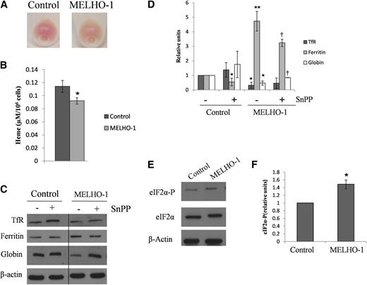 Figure 2. HO-1 overexpression leads to decreases in heme and globin levels and increases ferritin and eIF2α-P protein levels in MEL cells after their differentiation. MEL cells were stably transfected with HO-1 and incubated with DMSO for 72 hours. (A) After DMSO-induced differentiation, MELHO-1 cells exhibited a lower degree of redness than control cells. (B) After 72 hours of incubation with DMSO, MEL cells were harvested and washed, and their heme content was measured. (C) Representative western blot showing TfR, ferritin, and globin protein levels after 48 hours of incubation with DMSO; these cells were treated with and without SnPP (an inhibitor of HO activity). A vertical line has been inserted to indicate a repositioned gel lane. (D) Densitometric analysis of TfR, ferritin, and globin protein levels normalized to β-actin. *,**Statistical significance when compared with control cells without SnPP. †Statistical significance when compared with MELHO-1 cells without SnPP. (E) Representative western blot showing eIF2α-P protein levels in control and MELHO-1 cells after 48 hours of incubation with DMSO. (F) Densitometric analysis of eIF2α-P protein levels normalized to eIF2α-total and β-actin. Error bars of graphs represent standard deviation of 3 independent experiments (n = 3). *,†P < .05; **P < .001.