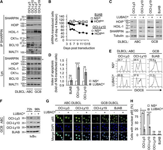 Figure 2. The LUBAC contributes to aberrant activation of NF-κB and survival of ABC DLBCL lines. (A) Cell lysates from ABC DLBCL lines (OCI-Ly3 and OCI-Ly10) and from GCB DLBCL lines (OCI-Ly7 and OCI-Ly19) were IP with antibodies to SHARPIN, and IBs were performed as indicated. The asterisk indicates nonspecific bands. (B) DLBCL lines were infected with a retrovirus that expressed a control nonspecific (NSsh) or a HOIPsh shRNA together with GFP. Shown is the fraction of GFP-positive cells over time relative to day 4 postinfection. (C) Lysates from OCI-Ly3, OCI-Ly10, OCI-Ly19, and BJAB cells transfected with control NS siRNA or with siRNA against the LUBAC (HOIP plus HOIL-1 plus SHARPIN) for 48 hours were analyzed by IB as indicated. (D-E) DLBCL lines were transfected as in (C) for 72 hours and stained with DiOC6 and analyzed by flow cytometry. Histograms in (D) represent the fold of NS-treated sample. Shown is the mean ± SEM from 3 independent experiments (ns, **P < .001; ****P < .0001 by ANOVA). (F) IκBα levels were assessed by IB 72 and 96 hours posttransfection in lysates as in (C). (G-H) ABC DLBCL lines (OCI-Ly3 and OCI-Ly10) and GCB DLBCL lines (OCI-Ly19 and BJAB) were transfected as in (C) for 72 hours. NF-κB p65 subcellular location was examined by confocal microscopy. Nuclei were illuminated with 4′,6-diamidino-2-phenylindole (DAPI). Histograms in (H) show the mean ± SEM from 3 independent experiments (ns, ****P < .0001 by ANOVA). Data are representative of 3 independent experiments.