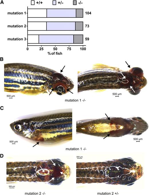Figure 2. Survival and bleeding of afibrinogenemic zebrafish. A generation of adult zebrafish from mating of heterozygous animals from each mutant line was genotyped for exon 2 of the fga gene aged 4 to 5 months. The percentage of fish for each fga genotype, wild-type (+/+), heterozygous (+/−), and homozygous mutant fish (−/−) is represented in A. The total number of live animals genotyped for each line in this generation is shown to the right of each bar. Compared with an expected Mendelian ratio, homozygous mutant fish (−/−) are underrepresented and wild-type (+/+) fish overrepresented in animals from heterozygous mutation 1 and 2 crosses. In B-D, unprompted bleeding events from mutation 1 and 2 fish are represented. Black and white arrows highlight sites of bleeding. B shows a cephalic and ocular bleed with right side (left) and dorsal views (right). C shows a ventral hemorrhage with left side (left) and ventral views (right), and D shows a dorsal view of a cephalic bleed (left) with a nonbleeding fish for comparison (right). Scale bars are given in each image. Images were acquired using a Leica MZ16FA stereomicroscope equipped with a DFC420 digital camera and the Leica Application Suite software V4.2. A ×1.0 Planapochromatic objective was used. The zoom magnification was between 0.71 and 1.48 with a visual magnification between 7.1 and 14.8. The numerical aperture was 0.020 (B-C) or 0.040 (D). Color was set to a saturation setting of 1.7 to 2.0 and γ at 0.99. Images were taken at room temperature.