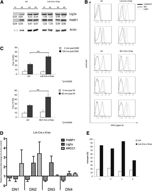 Figure 7. Primary murine KrasG12D-expressing T-ALL and preleukemic cells show increased levels of DNA misrepair. (A-C) Single-cell suspensions were prepared from the thymus of leukemic KrasG12D-expressing mice or control animals (KRAS wild type). (A) Immunoblot analysis using anti-Lig3α and PARP1 antibodies as indicated. To control equal loading, the blot was stripped and reprobed with an anti-actin antibody. Numbers indicate expression levels relative to actin determined by the means of densitometry. (B) Expression of intracellular Lig3α in primary thymocytes and fluorescence-activated cell sorter analysis (red, unstained; blue, immunoglobulin G-isotype control; yellow, anti-Lig3α-Alexa488). (C) Cells were treated with either (upper) daunorubicin (125 nM) or (lower) were irradiated (10 Gy). Cells were stained with an anti-γH2AX antibody and counterstained with DAPI. Shown is the percentage of cells with >5 foci relative to the total number of cells. Data shown represent mean values ± SD of 3 independent experiments. (**P = .0039, upper; **P = .0045, lower, Student t test). (D) RQ-PCR analysis of XRCC1, PARP1, and Lig3α in sorted preleukemic thymocyte subsets of double-negative (DN) populations (DN1, DN2, DN3, DN4) from Lck-Cre × KrasG12D mice (n = 6). (E) Nuclear extracts were prepared from preleukemic CD4/CD8 thymocytes (Lck-Cre × KrasG12D) or littermate control animals (Lck-Cre). Shown is the frequency of misrepaired colonies of 4 independent experiments.