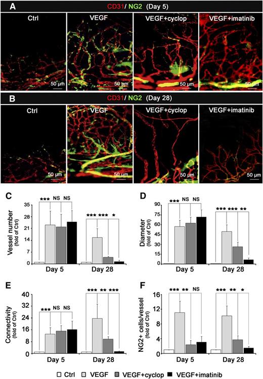Figure 6. Inhibition of Hh signaling pathway stimulates neovessel maturation and stability. VEGF-containing (5 µg) pellets in the presence or absence of Smo inhibitor (20 nmol cyclopamine, cyclop) or PDGFR-β inhibitor (20 nmol imatinib) were implanted into the cornea of C3HeB/FeJ mice (n = 8 per group) for 5 days (A) or 28 days (B). ECs were immunostained using anti-CD31 antibody (red, Alexa 564) and MCs with anti-NG2+ antibody (green, Alexa 488). Image capture was performed with Zeiss Observer Z1 microscope (×20). Quantification of total vessel number (C), vessel diameter (D), vessel connections (E), and number of NG2+ cells per vessel (F), 5 days or 28 days after VEGF pellet implantation in the presence (gray histograms) or absence of cyclopamine (black). Data represent means ± SD of relative values vs control corneas. P > .05 (NS); **P < .005; ***P < .0005.
