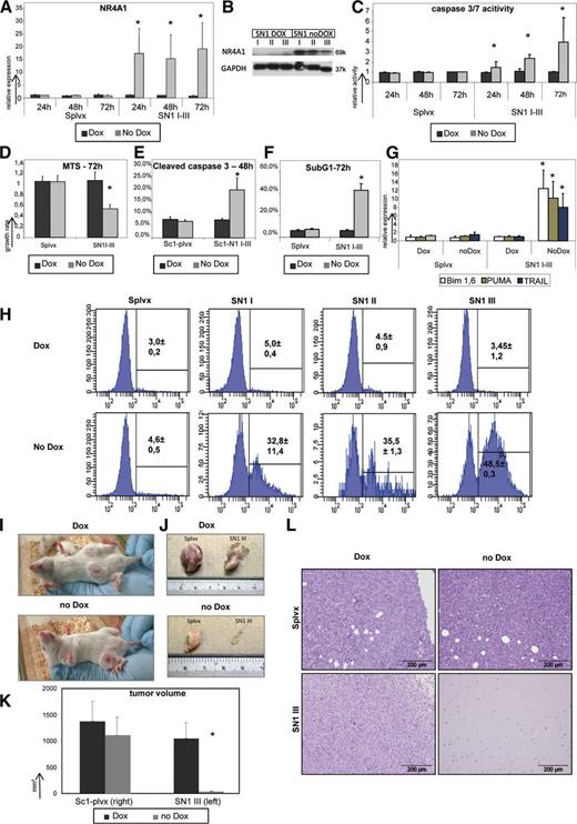 Figure 2. Functional characterization of NR4A1 in SuDHL4 lymphoma cells. Transduced SuDHL4 cells carrying empty vector (SpLVX) or the inducible NR4A1 construct (SN1 I-III) were cultured in the presence of doxycycline (DOX), no NR4A1 induction, or absence of doxycycline (No DOX), induction of NR4A1. (A) NR4A1 mRNA expression analysis after induction. Relative expression levels were calculated in comparison with Splvx cultured with doxycycline-containing media. Each bar represents the mean values of expression levels ± SD. * indicates a significant induction of NR4A1 compared with vector control and uninduced counterpart (P < .01). (B) Western blot analysis of NR4A1 expression with and without its induction in SuDHL4 carrying the inducible NR4A1 construct. GAPDH served as loading control. (C-F, H) Apoptotic and cell growth assay of transduced SuDHL4 carrying the empty vector (Splvx) or the inducible NR4A1 construct SuDHL4 (SN1 I-III) with and without doxycycline. To determine the apoptotic effects of NR4A1 in aggressive lymphoma cells, caspase 3/7 activity (C), caspase 3 cleavage (E), SubG1 peak (F), and annexin V (H) were estimated. Furthermore, cell growth analysis was performed by employing MTS assays (D). The caspase 3/7 activity and the MTS were calculated in comparison with Splvx lymphoma cells cultured with doxycycline-containing media. Annexin V staining and cleaved caspase 3 percentage were estimated by using fluorescence-activated cell sorter (FACS) analysis with specific fluorophore-labeled peptides or antibodies. SubG1 peaks were determined by cell cycle analysis using FACS analysis. * indicates significantly higher apoptotic activity or reduced cell growth compared with vector control and uninduced counterpart (P < .01). (G) mRNA expression levels of potential NR4A target genes of transduced SuDHL4 carrying the empty vector (Splvx) or the inducible NR4A1 construct (SN1 I-III) with and without doxycycline. * indicates significantly higher induction of TRAIL, BIM 1,6, and Puma to vector control and uninduced counterpart (P < .01). (I) Visual inspection of SuDHL4 lymphoma formation with an inducible NR4A1 construct (left flank) and vector controls (right flank) with and without doxycycline administration in the NSG xenograft model after 20 days. (J) Macroscopic analysis of tumors from SuDHL4 lymphoma cells carrying the inducible NR4A1 construct (left flank) and empty vector (right flank) with and without doxycycline administration after 20 days. (K) Estimation of tumor volume by using an ultrasonic device after 20 days. * indicates significant induction of NR4A1 compared with vector control and uninduced counterpart (P < .01). (L) Histologic analysis of tumors from SuDHL4 lymphoma cells carrying empty vector (upper row) or the inducible NR4A1 construct (lower row) and with (left column) and without doxycycline (right column) administration after 20 days (magnification ×100).