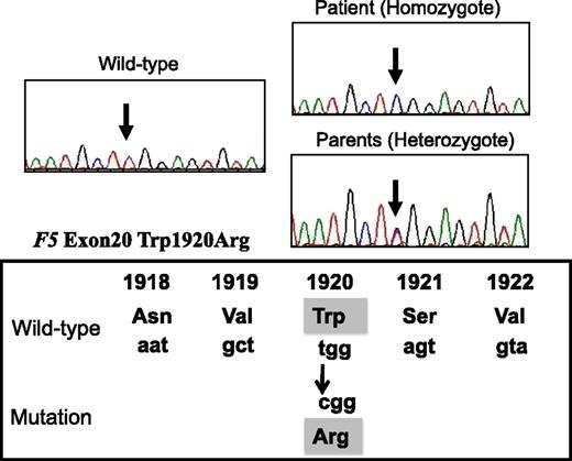 Figure 1. DNA direct sequencing of exon 20 of F5 gene from the patient, his parents, normal WT. The mutation (T–C) is present at codon 1920, resulting in a Trp1920→Arg substitution in the FV protein (FVNara).