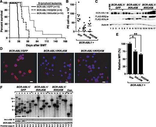 Figure 5. Kinase-inactive IKK mutants attenuate B-lymphoid leukemogenesis by BCR-ABL1 in mice. (A) Kaplan-Meier survival curve for B-ALL induced in mice by BCR-ABL1/GFP, BCR-ABL1/IKKαKM, or BCR-ABL1/IKKβKM. The number of individual mice in each arm is indicated. All recipients developed B-ALL. Coexpression of either IKKαKM or IKKβKM significantly prolonged the survival of mice with BCR-ABL1–induced B-ALL (P < .0001, Mantel-Cox test). In addition, mice with B-ALL induced by BCR-ABL1/IKKαKM survived significantly longer than those induced by BCR-ABL1/IKKβKM (P = .0007, Mantel-Cox test). (B) Total cell number collected from malignant pleural effusions in leukemic mice from the cohorts in panel A. Compared with B-ALL induced by BCR-ABL1/GFP, recipients with B-ALL induced by BCR-ABL1/IKKαKM (P = .0039) or BCR-ABL1/IKKβKM (P = .0393, Student t test) have significantly fewer leukemic cells in malignant pleural effusions. (C) Immunoblot analysis of protein lysates from pleural effusion lymphoblasts from mice with B-ALL induced by BCR-ABL1/GFP (lanes 2-5), BCR-ABL1/IKKαKM (lanes 6-12), or BCR-ABL1/IKKβKM (lanes 13-17). BM from an untransplanted mouse was loaded in lane 1 as a control. Lysates were analyzed with antibodies against c-Abl, FLAG, and actin. (D) Representative confocal micrographs of nuclear RelA expression in B-lymphoid leukemic cells from recipients of BM transduced with BCR-ABL1/GFP, BCR-ABL1/IKKαKM, or BCR-ABL1/IKKβKM. Cells were stained with antibody against RelA (Red) and counterstained with Hoechst dye (blue) as described in “Materials and methods.” Scale bars = 10 μm. (E) Quantification of nuclear RelA expression from the data in panel D (mean + SE). Leukemic cells expressing BCR-ABL1/GFP showed significantly higher nuclear RelA than cells expressing BCR-ABL1/IKKαKM (*P = .0003, Student t test) or BCR-ABL1/IKKβKM (**P < .0001, Student t test). (F) Analysis of genomic DNA from leukemic tissues of mice with B-ALL induced by BCR-ABL1/GFP (lanes 1-6), BCR-ABL1/IKKαKM (lanes 7-12), or BCR-ABL1/IKKβKM (lanes 13-19) by Southern blot with IRES probe to detect distinct proviral integration events. Two control DNAs (Con, lanes 20-21) were from cell lines that each contain a single BCR-ABL1 provirus. B-ALLs induced by BCR-ABL1/IKKαKM (P = .001, Student t test) and BCR-ABL1/IKKβKM (P = .0057, Student t test) showed significantly decreased frequency of leukemia-initiating cells as compared with BCR-ABL1/GFP. Because of the lower titers consistently obtained for BCR-ABL1 retroviruses coexpressing IKKα/βKM (supplemental Figure 1), we used more dilute BCR-ABL1/GFP retrovirus to match titers, resulting in a lower average number of proviral clones in the GFP control arm than in Figure 2B.