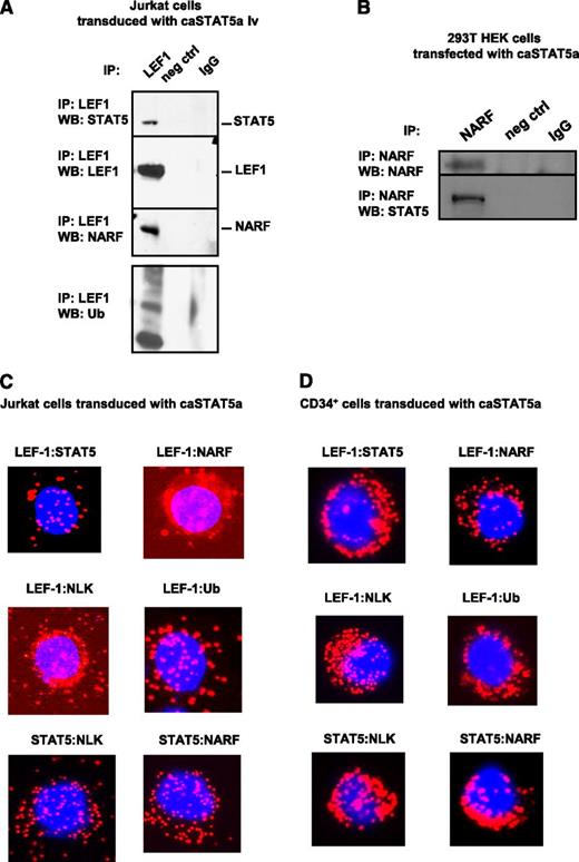 Figure 5. caSTAT5a-NLK-NARF–mediated ubiquitination of LEF-1. Interactions between LEF-1, STAT5, NARF, and NLK proteins as well as LEF-1 ubiquitination: (A) lysates of Jurkat cells transduced with caSTAT5A were immunoprecipitated with a polyclonal anti–LEF-1 antibody and the immunoprecipitates were subjected to western blot analysis with anti–LEF-1, anti-STAT5, anti-NARF, anti-NLK, or anti-ubiquitin antibodies. Representative western blot images are shown; (B) lysates of 293T HEK cells transfected with caSTAT5A were immunoprecipitated with anti-NARF antibody and the immunoprecipitates were subjected to western blot analysis with anti-NARF or anti-STAT5 antibodies; representative western blot images are shown. (C-D) Interactions between LEF-1 and STAT5, LEF-1 and NARF, LEF-1 and NLK, LEF-1 and ubiquitin, STAT5 and NLK, and STAT5 and NARF were detected in (C) Jurkat cells and (D) CD34+ cells treated with G-CSF using Duolink. DAPI, stained nuclei; Cy3 red dots, protein interactions.