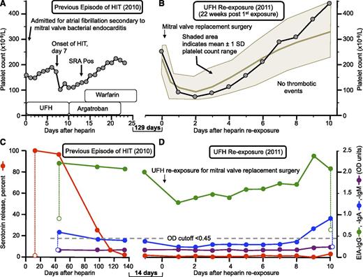 Figure 3. Repeat heparin exposure in the presence of a positive baseline EIA (patient 20). (A) Previous episode of HIT (2010). (B) Platelet counts after UFH rechallenge (2011) for urgent cardiac surgery (severe mitral regurgitation). (C) Anti-PF4/heparin antibodies and SRA results at the time of the previous episode of HIT and (D) at heparin rechallenge approximately 5 weeks after the first negative SRA. The data illustrate an uneventful UFH reexposure despite a moderate positive EIA-IgG (1.98 OD units)—with a negative SRA—at time of heparin rechallenge, which was accompanied by increase in IgG levels to almost 2.50 OD units as well as weak IgA seroconversion. The shaded area indicates a platelet count range expected for a postcardiac surgery patient population.2 Pos, positive; SD, standard deviation.