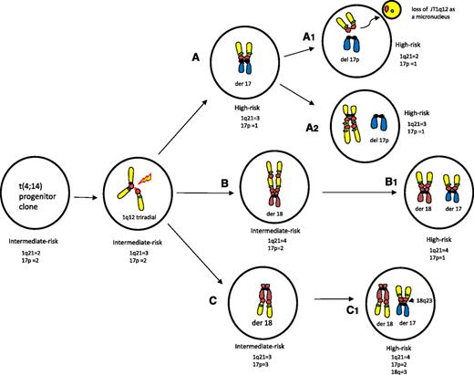 Figure 7. Characterization of alternative pathways and possible CNAs associated with the deletion 17p in progenitor clones with t(4;14). Key cytogenetic translocations resulting in CNAs for risk are indicated inside of clones. Note: FISH probes depicted in cartoon are 1q12 (red) and 1q21 (green) and chromosome arm colors are 1 (yellow), 17 (blue), 18 (auburn). Subclone A depicts clones of patient 12, B of patient 36, and C of patient 46. Arrows indicate probable derivation of subclones. The JT1q12 instability originates from a triradial of 1q (second from left), which results in an extra copy of the JT1q12 translocating to different RCs (subclones A-C). Subclone A shows that the JT1q12 can translocate directly to chromosome 17 resulting in a der(1;17) with a whole-arm loss of 17p and gain of 1q21 and a high-risk subclone. Subsequent subclones are also high risk, although JT1q12s can be lost as micronuclei (A1) and/or reconfigure on the same or different RC and 1q21 CN and remain stable (A2). In subclones B and C, different sequential translocations of JT1q12 result in high-risk subclones as well. Subclone B demonstrates the JT1q12 translocation first to18p in an intermediate risk clone and second to 17p, resulting in a high-risk subclone (B1). The detection of the high-risk clone (B1) 5 months before the detection of the intermediate-risk progenitor clone (B) in this patient suggests that alternating dominance or clonal tiding had occurred. In subclone C, the JT1q12 first translocates to the 18q23 telomere, resulting in a der(1;18) chromosome aberration and an intermediate-risk subclone. The second JT1q12 translocation from 18q23 to17 results in a high-risk clone with a focal amplification of 18q23, gain of 1q21, and deletion of 17p (C1).