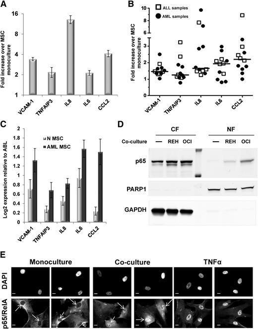 Figure 1. Coculture with leukemia cells induces NF-κB activation in BM-MSCs. (A) A group of array-identified upregulated genes in cocultured BM-MSCs was validated by qRT-PCR. The bars represent qRT-PCR data from 3 independent experiments, and results are expressed as fold difference expression (±SEM) in the cocultured BM-MSCs vs the monocultured BM-MSCs. (B) A total of 5 ALL and 7 AML patient samples were independently cocultured with BM-MSCs and processed as in A. Data from qRT-PCR analysis are expressed as fold difference expression in cocultured BM-MSC vs the monocultured BM-MSCs. Mean expression value for each gene is shown as a bar. (C) qRT-PCR analysis showing expression levels of a selected group of NF-κB target genes in AML-MSCs (n = 12) compared with N-MSCs (n = 8). A total of 12 AML-derived and 8 normal donor-derived primary MSC cultures were analyzed. Bars represent the mean value (±SEM) Log2 expression levels relative to ABL (housekeeping control) expression levels. (D) Western blot analysis of cytosolic (CF) and nuclear (NF) fractions of lysates from BM-MSCs cultured alone (−) or cocultured with REH or OCI-AML3 cells for 1 hour. Each well corresponds to 5 µg of total protein. Membranes were probed with rabbit monoclonal anti-p65, mouse monoclonal anti-PARP1 (nuclear fraction loading control), and mouse monoclonal anti-glyceraldehyde-3-phosphate dehydrogenase (cytosolic fraction loading control). (E) Immunofluorescence staining for p65/RelA showing p65 translocation into BM-MSC nuclei on interaction with leukemia cells in coculture conditions. BM-MSCs were cultured alone (monoculture) or cocultured with REH cells for 24 hours and then fixed with 4% paraformaldehyde (PFA). As controls, BM-MSCs cultured alone were treated with vehicle or TNFα (20 ng/mL) for 30 minutes. Nuclei were counterstained with DAPI. Scale bar, 10 µm. Arrows point at absence (monoculture panel) or presence (coculture panel) of p65 in nuclei.