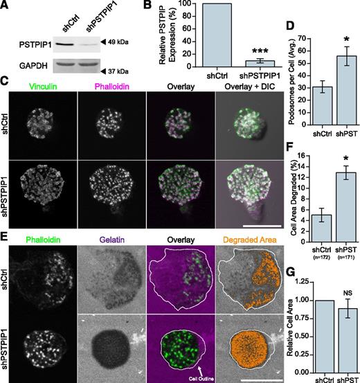 Figure 1. PSTPIP1 impairs podosome formation. (A-B) Lentiviral transduction of shRNA was used to knock down PSTPIP1 in THP-1 cells. (A) Western blot of lysates from the control (shCtrl) and PSTPIP1 knockdown (shPSTPIP1 or shPST) THP-1 cells using anti-PSTPIP1 and anti–glyceraldehyde 3-phosphate dehydrogenase (GAPDH) antibodies (loading control). Arrowheads indicate location of molecular weight markers. (B) Quantification of PSTPIP1 knockdown in which PSTPIP1 expression in shCtrl cells was normalized to 100%. (C) Representative images of podosomes in shCtrl and shPSTPIP1 THP-1 macrophages. Podosomes were stained with anti-vinculin antibody (green) and rhodamine phalloidin (magenta). (D) Quantification of the average number of podosomes formed by shCtrl and shPSTPIP1 THP-1 cells. (E) Representative images of gelatin degradation by PSTPIP1 knockdown cells on Alexa Fluor 568–conjugated gelatin (magenta) coverslips. Podosomes were stained with Alexa Fluor 488 phalloidin (green). The cell outline is a trace of the cell border made from the phalloidin image. Orange pixels in the Degraded Area panel were those counted as degraded. (F) Quantification of the amount of gelatin degraded by PSTPIP1 knockdown cells as a percentage of cell area. (G) Cell area was determined in all cells for the degradation experiment and normalized to the shCtrl value. Scale bars, 20 μm. All values are mean ± standard error of the mean (SEM) from 3 (D,F,G) or 4 (B) independent experiments. *P < .05; ***P < .001 as determined by a paired Student t test (B,D,G) or ANOVA with repeated measures using a compound symmetry correlation structure (F). NS, nonsignificant.