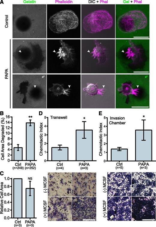 Figure 3. PAPA patient macrophages make membrane projections associated with matrix degradation and have enhanced invasive properties. (A) Representative images of gelatin degradation by control and PAPA macrophages on Oregon Green 488 gelatin-coated coverslips (green). Podosomes and membrane projections were stained with rhodamine phalloidin (magenta). Areas degraded by the macrophages appear black in the gelatin image. Arrowheads indicate projections overlaying degraded areas. (B) Quantification of gelatin degraded by control and PAPA macrophages as a percentage of the total cell area. (C) Cell area was determined for all cells in the assay and normalized to the value of the control macrophages. (D-E) Quantification of macrophage chemotaxis to macrophage colony-stimulating factor (M-CSF) in (D) Transwell devices or (E) Matrigel-coated invasion chambers. Chemotactic index is the ratio of cells migrating to M-CSF over medium alone. Representative images of the filters are shown below. Scale bars, 20 μm (A) or 500 μm (D,E). All values are mean ± SEM from 3 independent experiments. *P < .05; **P < .01 as determined by a paired Student t test (C) unpaired Student t test (D,E) or ANOVA with repeated measures using a compound symmetry correlation structure (B).