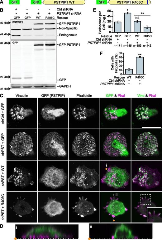 Figure 4. PSTPIP1-R405C promotes filopodia formation. (A) Diagram of constructs introduced into control and PSTPIP1 knockdown cells by retroviral transduction to make rescue cell lines. (B) Representative western blot of lysates from FACS-sorted THP-1 rescue lines showing expression of rescue constructs. Blots were probed with mouse anti-PSTPIP1, rabbit anti-GFP, and mouse anti-GAPDH (loading control) antibodies. Arrowheads indicate location of molecular weight markers. (C) Representative images of podosomes and filopodia formed by the THP-1 rescue cell lines, which were stained with anti-vinculin antibody (green) and rhodamine phalloidin (magenta). Anti-GFP antibody (green) was used to amplify the GFP signal. Inset shows filopodia at ×1.5 original magnification. (D) Slices through the Z-plane of the shPST + WT and shPST + R405C cells were created with the Reslice function in FIJI software as indicated by the dashed lines in (C). (E) Quantification of the average number of podosomes formed by the indicated rescue line. shCtrl + GFP was the reference value for statistical comparison except where indicated by a bar. (F) Quantification of the percentage of shPST + WT and shPST + R405C cells that form filopodia. Scale bars, 20 μm. All values are mean ± SEM from 3 independent experiments. *P < .05; **P < .01 as determined by ANOVA with repeated measures using a compound symmetry correlation structure (E) or paired Student t test (F). NS, nonsignificant.