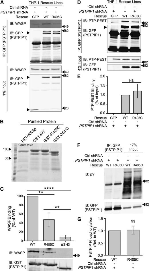 Figure 6. PSTPIP1-R405C has impaired interaction with WASP but not PTP-PEST. (A) Anti-GFP antibody was used to immunoprecipitate GFP or GFP-tagged PSTPIP1 constructs from the indicated THP-1 rescue cell lines. Blots were probed with anti-GFP antibody and anti-WASP antibody to visualize the coimmunoprecipitation (IP) of WASP. Equivalent loading was determined by probing a blot of the lysates as above. (B) His-tagged WASP or GST-tagged PSTPIP1 proteins (labeled as GST-WT, GST-R405C, and GST-ΔSH3) were purified from E coli. They were separated by sodium dodecyl sulfate polyacrylamide gel electrophoresis (SDS-PAGE) and stained with Coomassie brilliant blue to assess purity. (C) Pulldown assay using the purified proteins described in (B). Soluble His-WASP was incubated with the indicated bead-bound GST-PSTPIP1 construct. Blots were probed for WASP and GST (to detect PSTPIP1) to determine the degree of interaction. The amount of WASP pulled down by the GST-PSTPIP1 mutants was normalized to the interaction with GST-PSTPIP1-WT. (D) Anti-GFP antibody was used to coimmunoprecipitate PTP-PEST with GFP or GFP-tagged PSTPIP1 constructs from the indicated THP-1 rescue cell lines. Anti–PTP-PEST and anti-GFP antibodies were used to probe the immunoprecipitation and input blots. (E) Quantification of the amount of PTP-PEST coimmunoprecipitating with PSTPIP1 was determined as a percent of input and normalized to the PSTPIP1-WT value. (F) Anti-GFP antibody was used to immunoprecipitate GFP-PSTPIP1-WT or -R405C from THP-1 rescue cells. Immunoprecipitates and lysates were probed with anti-phosphotyrosine (4G10 platinum) and anti-GFP antibodies to assess PSTPIP1 phosphorylation. (G) Quantification of the phosphorylation of PSTPIP1-WT and -R405C is shown relative to WT. Unlabeled arrowheads indicate the band(s) of interest in each panel. Labeled arrowheads indicate the locations of the molecular weight markers (kDa). All values are mean ± SEM from 3 (C,G) or 4 (E) independent experiments. **P < .01; ****P < .0001 as determined by one-way ANOVA with Sidak’s multiple comparisons test (C,E) or paired Student t test (G). IB, immunoblotting. NS, nonsignificant.