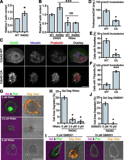 Figure 7. WASP mediates the transition to filopodia in PSTPIP1-R405C cells. (A) The F-actin polymerizing ability of PSTPIP1-WT and -R405C rescue cells was determined by stimulating serum-starved cells with chemokine (C-C motif) ligand 2. F-actin was saturated with rhodamine phalloidin and extracted with methanol; fluorescence was determined with a plate reader. Fluorescence intensity was normalized to the level of PSTPIP1-WT cells for each experiment. (B) F-actin content assay performed as in (A). Prior to stimulation, cells were pretreated for 30 minutes with dimethyl sulfoxide (DMSO) or 10 μM wiskostatin. Stimulation was performed in the presence of DMSO or 20 μM wiskostatin (Wisko) for 5 minutes. DMSO-treated WT was the reference value for statistical comparison except where indicated by a bar. (C-F) Macrophages nucleofected with GFP-Cdc42 WT (WT) or GFP-Cdc42 Q61L (CA) were plated on fibrinogen-coated coverslips overnight and stained with rhodamine phalloidin, anti-vinculin antibody, and anti-GFP antibody to visualize podosomes and Cdc42 expression. (C) Representative images of podosomes and filopodia in Cdc42-nucleofected cells. GFP-positive cells were used for (D) quantification of the average number of podosomes per cell, (E) the percentage of cells that made podosome rosettes, and (F) the percentage of cells forming filopodia. (G-J) THP-1 shPST + R405C rescue cells were plated on Alexa Fluor 568–conjugated gelatin for 3 hours with the indicated concentration of (G) wiskostatin or (I) GM6001. Representative images are shown. (H) The amount of degradation in the presence of wiskostatin is shown as a percentage of cell area (0 μM, n = 112; 2.5 μM, n = 134; 5 μM, n = 138). (J) The amount of degradation in the presence of GM6001 is shown as a percentage of cell area (0 μM, n = 125; 10 μM, n = 131). All values are mean ± SEM from 3 (B,H,J) or 4 (A,D-F) independent experiments. *P < .05; ***P < .001 as determined by (A) unpaired Student t test, (B) one-way ANOVA with Sidak’s multiple comparison test, (D-F) paired Student t test, or (H,J) ANOVA with repeated measures using a compound symmetry correlation structure.