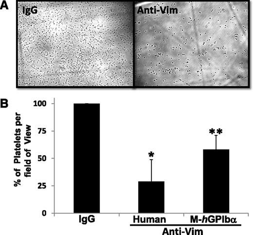 Figure 3. Effect of anti-vimentin antibody on flow-dependent platelet adhesion to A1A2A3 protein. Whole blood from human or mice expressing human (h)GPIbα in platelets was mixed with sheep IgG molecule (negative control) or sheep anti-vim antibody (100 μg/mL) and perfused over a surface coated with WT A1A2A3 protein at a shear rate of 1500 seconds−1. After a 2-minute perfusion, the plates were washed with buffer, and attached platelets were recorded and quantified as described in “Methods.” (A) A representative photomicrograph of the effect of the anti-vim antibody on platelet adhesion to the A1A2A3 surface using human blood. (B) The bar graph shows the percent of platelets (mean ± SD) on the surface of 15 different fields of view for human, *P < .03, or mice, **P < .05.