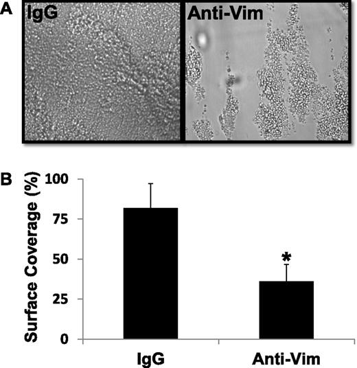 Figure 4. Effect of anti-vimentin antibody on flow-dependent platelet adhesion to fibrin(ogen). Whole blood containing sheep IgG molecule or sheep anti-vim antibody was mixed with ristocetin (0.5 mg/mL) and perfused over surfaces coated with fibrin(ogen) at a shear rate of 1500 seconds−1. After a 2-minute perfusion, the plates were washed with buffer, and attached platelets were recorded and quantified as described in “Methods.” Photomicrographs represent 3 separate experiments. The bar graph shows the percent of surface covered by firmly adhered platelets in 15 fields of view (mean ± SD, *P < .01).