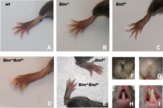 Figure 1. Impaired developmentally programmed apoptosis in mice lacking Bim and Bmf. Bim and Bmf mediate the removal of interdigitating mesenchymal cells in (A) WT, (B) Bim−/−, and (C) Bmf−/− mice, whereas (D-E) Bim−/−Bmf−/− mice present with soft tissue syndactyly, (G) vaginal aplasia, and (I) malocclusion of the incisors, (A,F,H) phenotypes that are not or only rarely observed in single knockout mice or WT control animals.