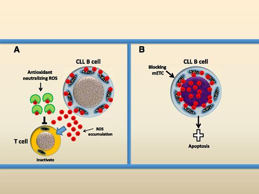 Two opposite therapeutic redox-modulating strategies for the treatment of CLL. (A) Using antioxidant to neutralize ROS, CLL cells produce and release ROS into the microenvironment and ROS are dangerous to T cells. Antioxidant can neutralize ROS and prevent ROS-mediated damage to T cells. (B) Rapid induction of ROS. Blocking the mETC causes rapid ROS production by mitochondria and this could induce apoptotic cell death of CLL cells.