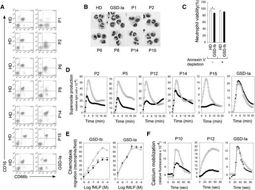 Figure 1. G6PT-deficient neutrophils of GSD-Ib patients with varying maturation states were dysfunctional. (A) Analysis of the levels of total (CD66b+) and immature (CD66b+CD16−/lo) neutrophils in the fixed, erythrocyte-depleted blood leukocytes by flow cytometry using CD66b and CD16 antibodies. Representative profiles from HDs and GSD-Ib and GSD-Ia patients are shown. (B) Hema-3–stained cytospins of isolated peripheral blood neutrophils. (C) Viability of freshly isolated and annexin V–depleted neutrophils. Annexin V–depleted blood neutrophils were used for respiratory burst, chemotaxis, and calcium mobilization analyses. (D) Neutrophil respiratory burst activity in response to PMA. Representative experiments are shown. (E) Neutrophil concentration-dependent chemotaxis in response to fMLP. Data represent the mean ± standard error of the mean (SEM) of 5 patients (P1, P8, P10, P12, and P14) examined in separate experiments. **P < .005. (F) Calcium mobilization in response to 10−7 M of fMLP. Representative experiments are shown. ○, HDs; ●, GSD-Ib patients; ▲, GSD-Ia patients.