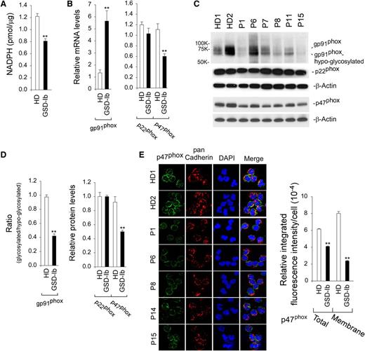 Figure 3. Analysis of NADPH and the expression of NADPH oxidase in G6PT-deficient neutrophils of GSD-Ib patients. Annexin V–depleted peripheral blood neutrophils isolated from HDs and GSD-Ib patients were used in the study. (A) Levels of neutrophil NADPH. Data represent the mean ± SEM for HDs (n = 7) and GSD-Ib patients (n = 6). (B) Quantification of gp91phox, p22phox, and p47phox mRNA by real-time RT-PCR. Data represent the mean ± SEM for HDs (n = 10) and GSD-Ib patients (n = 12). (C) Western blot analysis of protein extracts using antibodies against gp91phox, p22phox, p47phox, or β-actin. Each lane contains 50 μg of protein. (D) The relative protein levels of gp91phox, p22phox, and p47phox were quantified by densitometry. Data represent the mean ± SEM for HDs (n = 6) and GSD-Ib patients (n = 6). (E) Confocal analysis of p47phox (green fluorescence), pan Cadherin membrane staining (red fluorescence), and DAPI nuclei staining (blue fluorescence) at original magnification ×630 and quantification of the relative integrated fluorescence intensity by ImageJ. The p47phox translocation from the cytoplasm to the plasma membrane was demonstrated by colocalization of p47phox with the plasma membrane marker pan Cadherin. **P < .005.