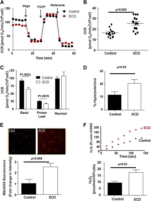Figure 2. SCD platelets show bioenergetic dysfunction. (A) Representative platelet bioenergetic profile from an SCD patient (red) and healthy control (black). (B) Rotenone-insensitive OCR of control and SCD patient platelets. Bars represent mean ± SEM. (C) Quantification of each OCR component of bioenergetic profile of platelets for an SCD patient and control after correction for nonmitochondrial OCR (n = 24 SCD; 19 controls). (D) Quantification of the percent of hyperpolarized mitochondria in platelets from SCD and control subjects (n = 16 each group). (E) Representative MitoSOX fluorescence images from control and SCD platelets and relative fluorescence intensity of MitoSOX labeling in control and SCD platelets (n = 18 each group). (F) Representative Amplex Red traces and quantification of H2O2 generation (normalized to 106 cells) from control and SCD platelets (n = 14 each).