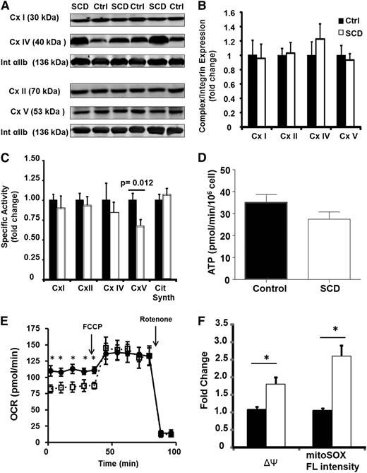 Figure 3. SCD platelets have inhibited complex V activity. (A) Representative western blots for complexes I, II, IV, and V and integrin αIIb in 3 control and 3 SCD subjects. (B) Densitometric quantification of several such blots in 12 control and SCD platelets. (C) Enzymatic activity of each ETC complex in platelets from SCD patients (black bars) and healthy controls (white bars; n = 15). (D) ATP generation rate in SCD (black bars) and control (white bars) platelets (n = 10 each). (E) Bioenergetic profile (basal and FCCP-induced OCR) for untreated (filled circles) or oligomycin treated (open squares) platelets. (F) ΔΨ and MitoSOX fluorescence intensity of untreated (black bars) or oligomycin-treated (white) healthy platelets (n = 5, *P < .01).