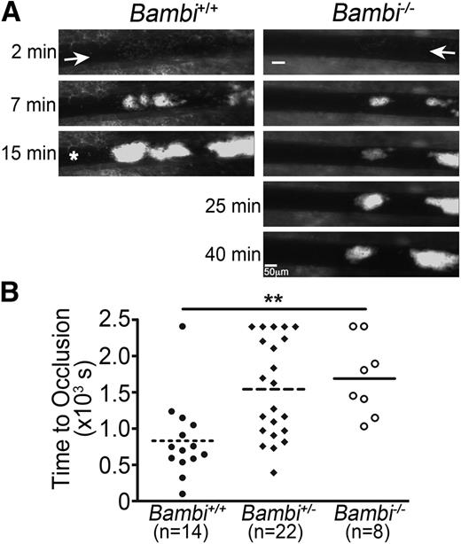 Figure 2. Impaired thrombus formation in Bambi-deficient mice after FeCl3 injury in vivo. (A-B) Mesenteric arterioles were injured with FeCl3 and adhesion and thrombus formation of fluorescently labeled platelets was followed by intravital microscopy. (A) Representative images of thrombus formation at indicated times after removal of the filter paper. Scale bar represents 50 µm. A white asterisk indicates occlusion of the vessel for the wild-type mouse. (B) Bambi+/− and Bambi−/− mice displayed a delayed vascular occlusion compared with Bambi+/+ littermates. Each symbol represents 1 animal. Horizontal lines intersecting data sets represent the mean. Statistical analysis was performed using ANOVA (Kruskal-Wallis). **P < .01.