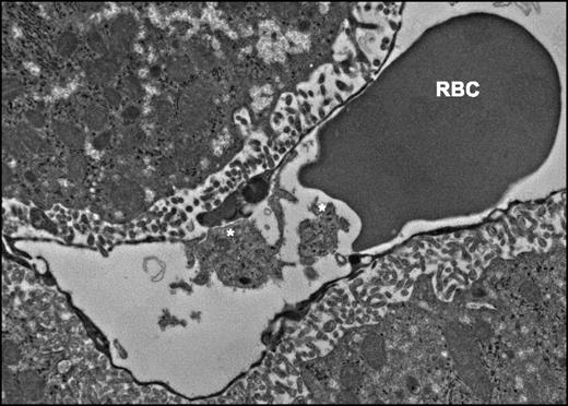 Figure 2. Platelet and liver sinusoid interactions in a Plasmodium berghei–infected mouse (* denotes platelets).